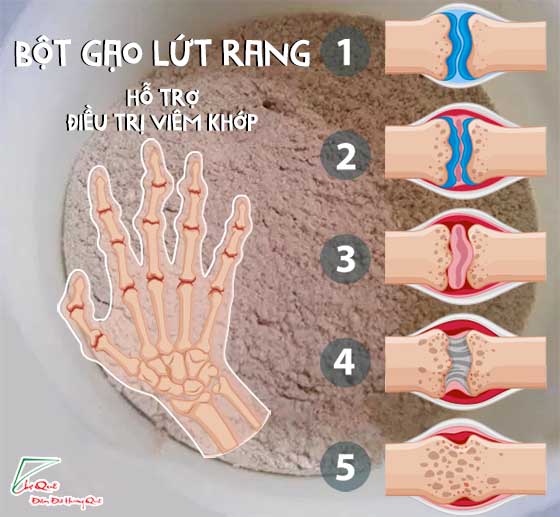 bột gạo lứt rang có hỗ trợ điều trị viêm khớp